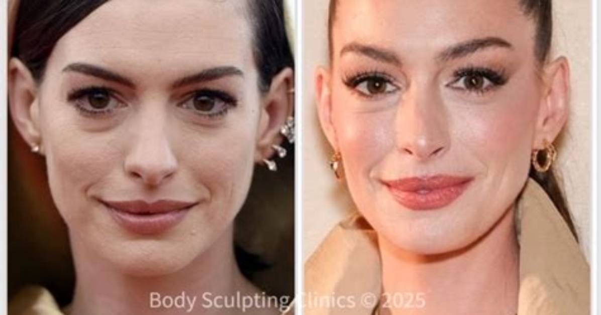Anne Hathaway S Anti Aging Routine Everything She Uses to Maintain Her