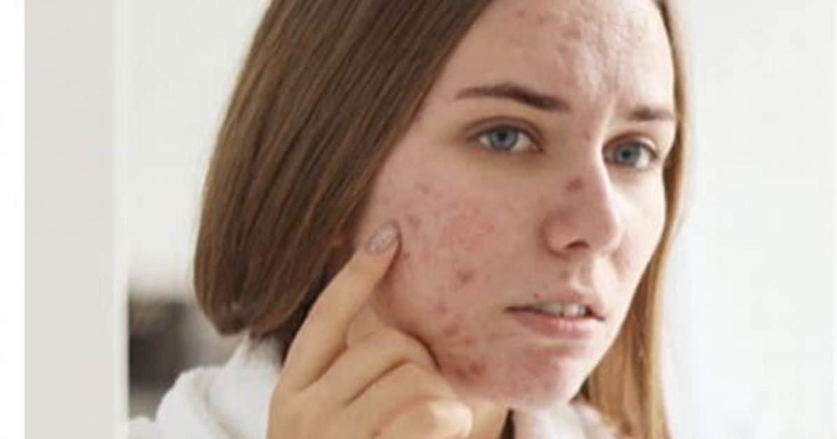 Are You Truly Allergic to Your Skincare Dermatologists Unpack Product Toxicity And