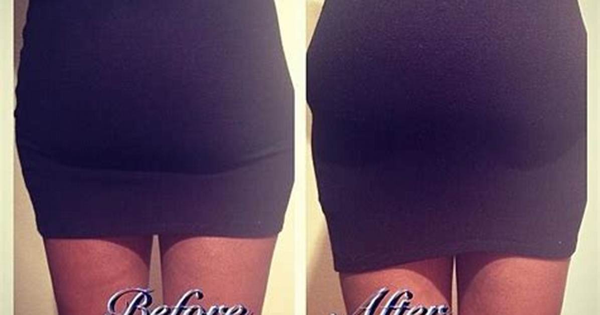 Before and After How Butt Sculpting