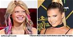 Chanel West Coast Teeth Before and After 2021: Visual Evidence and Procedure Breakdown