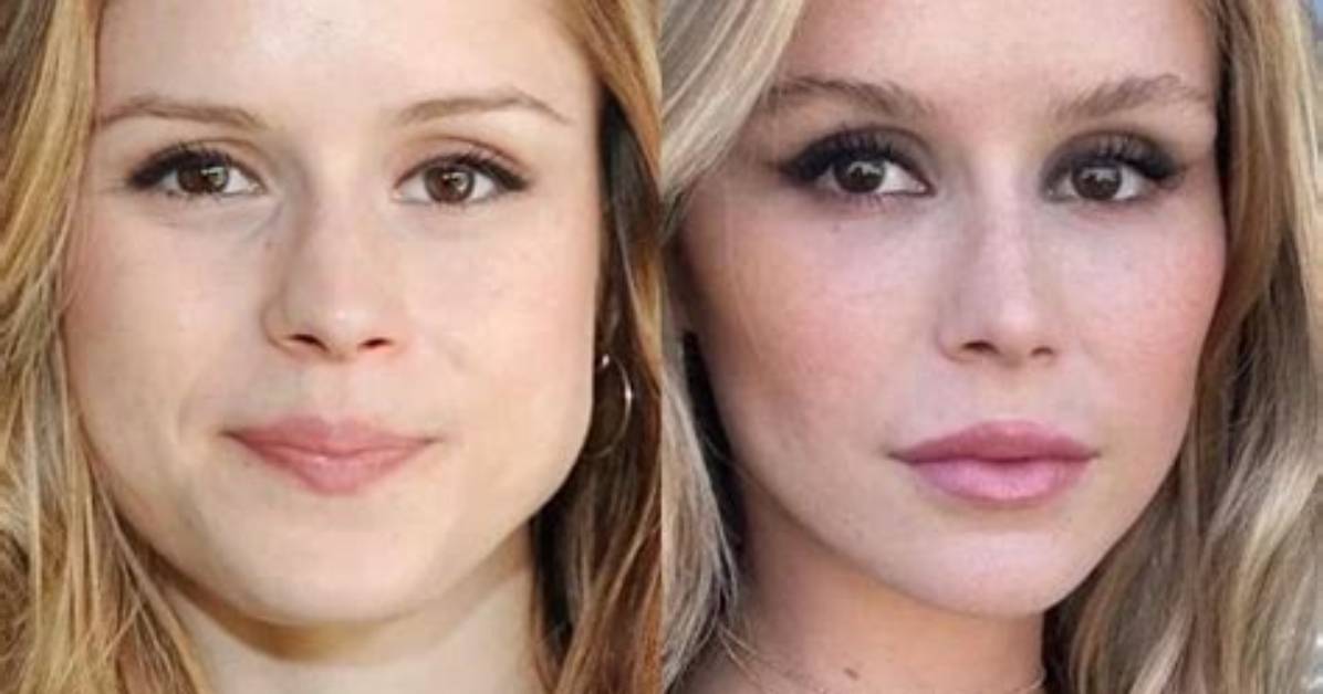 Did Erin Moriarty Get Plastic Surgery Fact Checking The