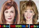 Did Lauren Holly Have Plastic Surgery? the Truth Behind the Star's Ageless Look