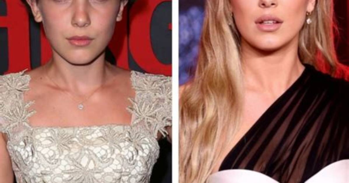 Did Millie Bobby Brown Get Plastic Surgery Experts Break Down Natural