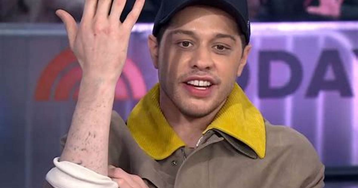 Did Pete Davidson Actually Go Under the Knife a Fact