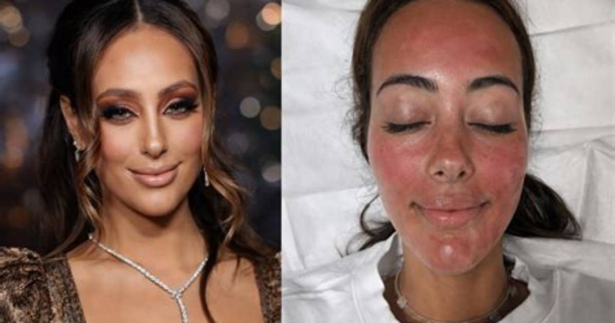 Emira D Spain Before and After Inside Her Transformative Rise And
