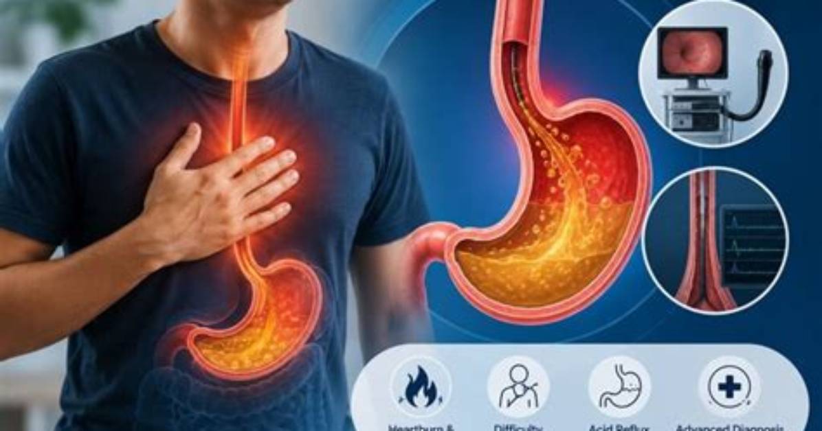 Is It Just Acid Reflux or Something Worse Debunking Stomach