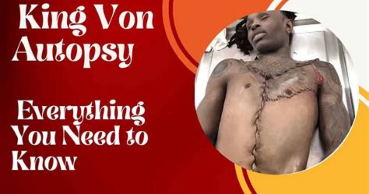 King Von Autopsy Results Explained Answers to the Most Searched Questions Around His