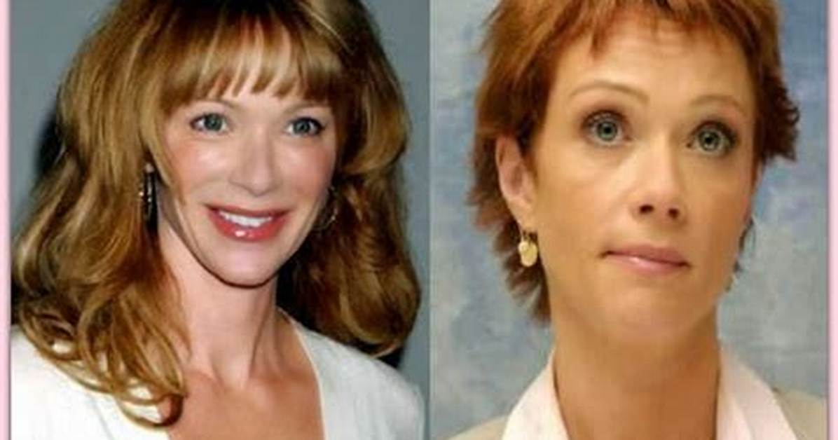 Lauren Holly Plastic Surgery Faq Answers to Fans Most