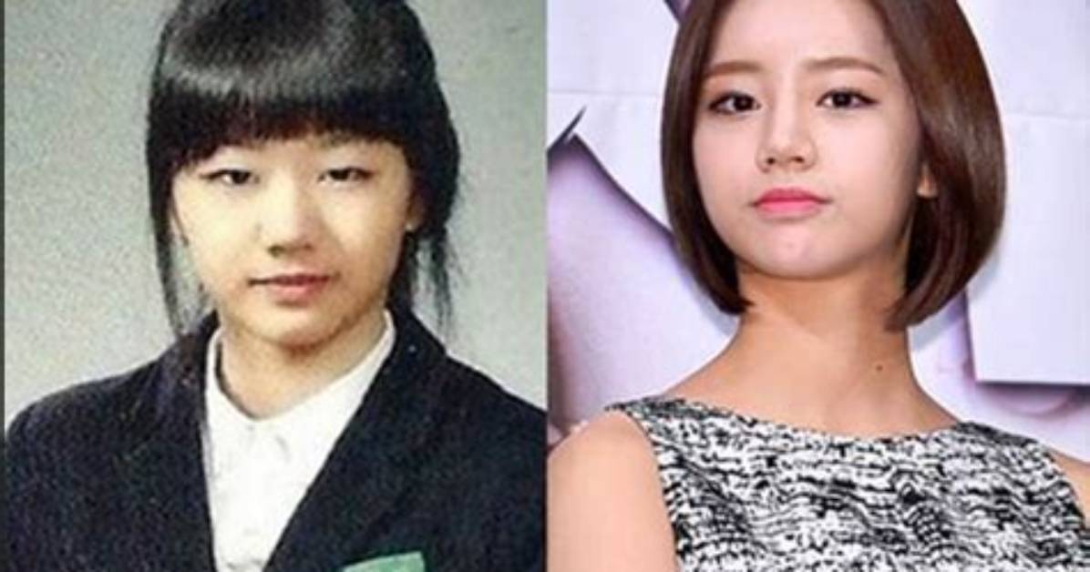 Lee Hyeri S Screen Transformation Comparing Her Weight and Fitness Across