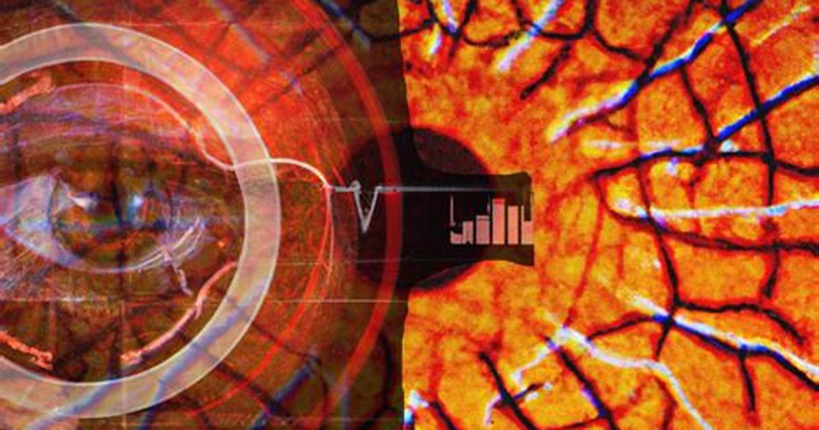 Looking Through the Eyes How Retinal Biomarkers and Doppler Waves Expose Abnormal