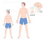 Medical Breakdown: What Pituitary Gigantism Actually Does to the Human Body