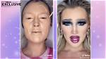 Meredith Duxbury Before and After Surgery Rumors: the Truth Behind Her Dramatic Facial Transformation