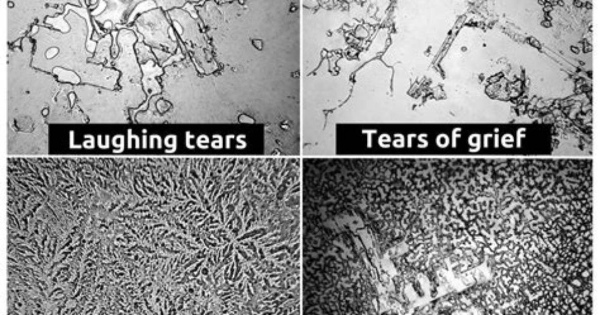 Microscopic Tears and Ring Prongs What Happens When You Glove Up