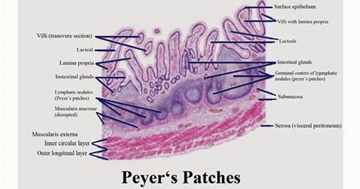 Peyer S Patches Explained Anatomy Immune Regulation And