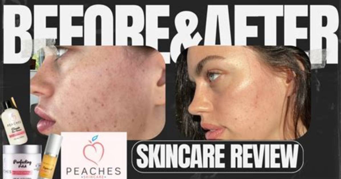Silky Peach Cream Real Before and After 30 Day Testing