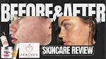 Silky Peach Cream Real Before and After: 30-Day Testing Results Exposed