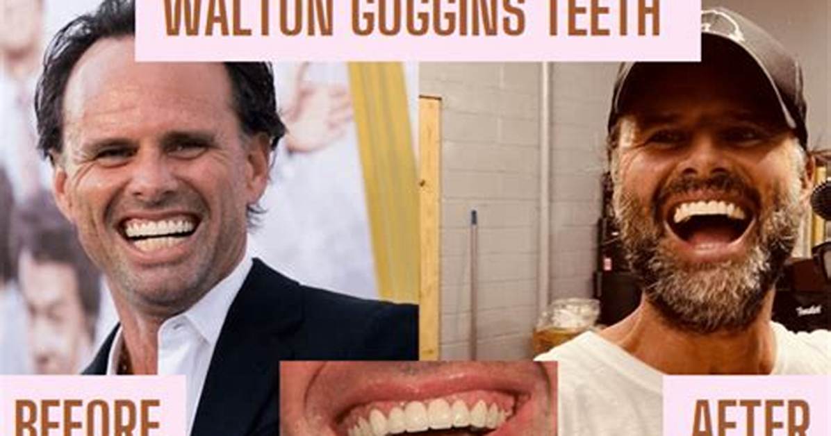 The Brutal Truth Behind Walton Goggins Teeth How He Lost