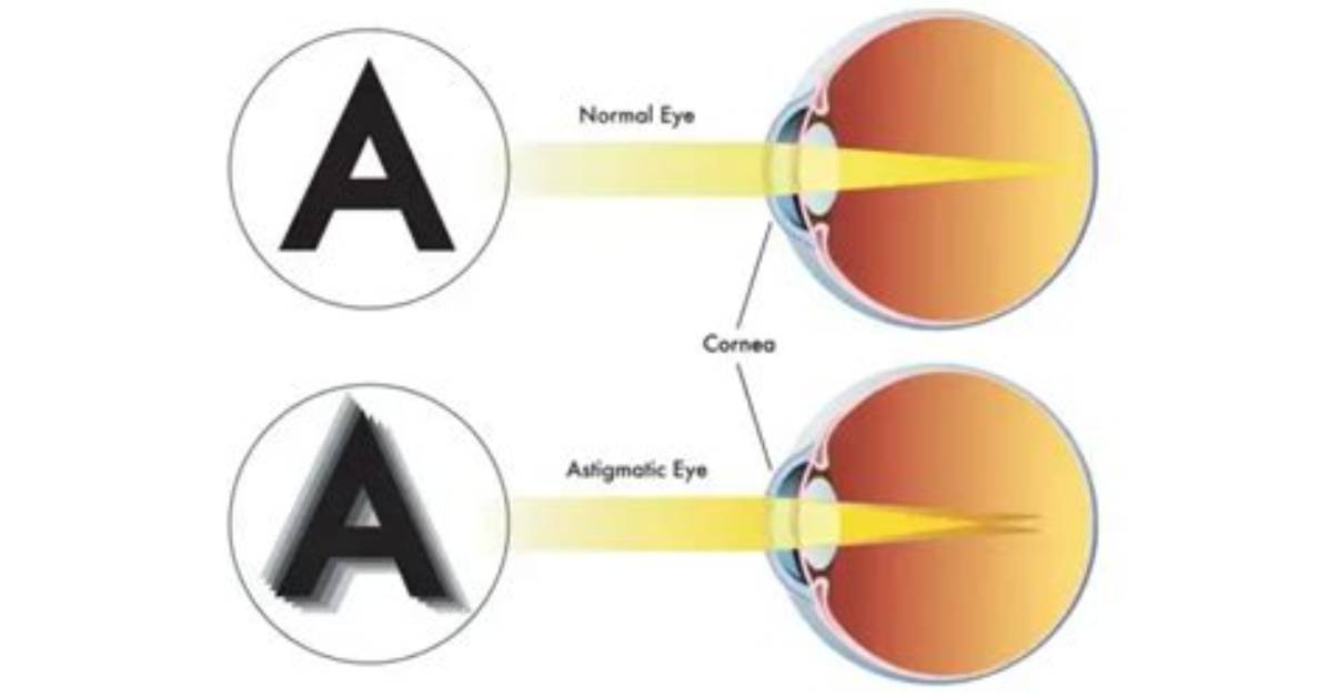 The Complete Guide to Conquering Astigmatism Glare Night Driving Tips Lenses And