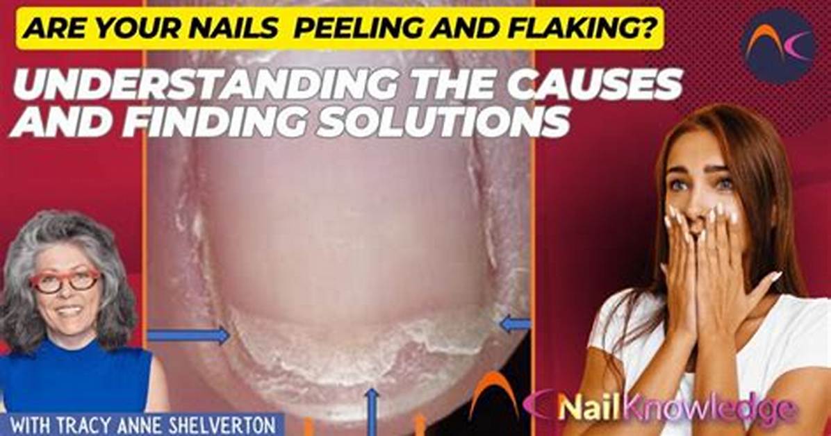 The Nail Salon Secret How Peeling False Nails Without Acetone Destroys Your