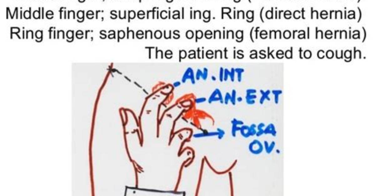The Three Finger Test Exposed What Actually Happens to Ai Video In