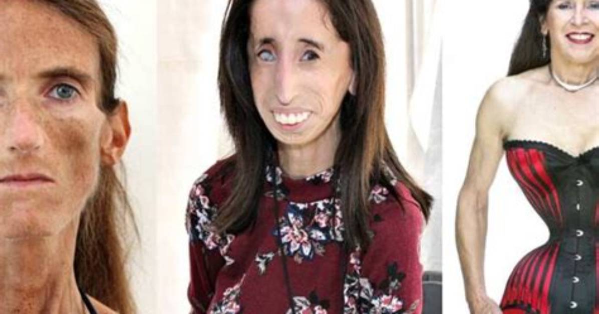 The World S Skinniest Person Debunking Internet Hoaxes and Examining The