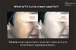 Tri-Luma Cream Before and After: Clinical Results on Stubborn Melasma
