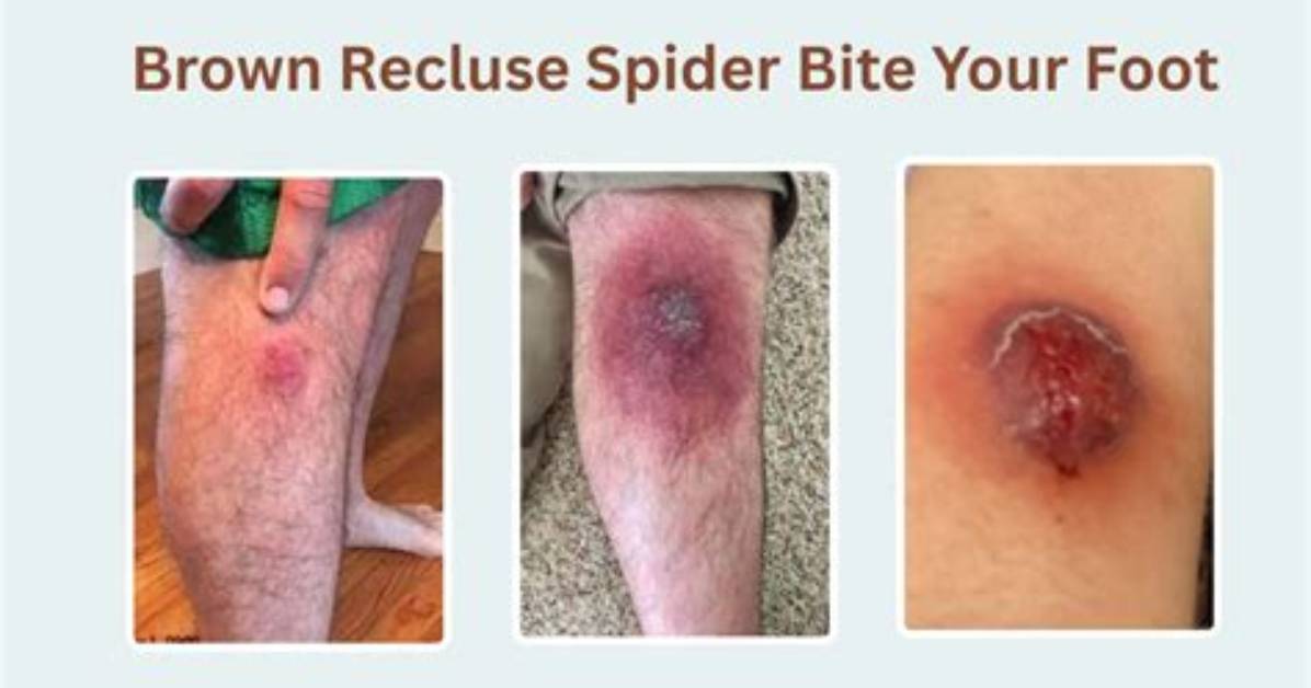What Does Recluse Mean Inside the Tragic Reality of Extreme Isolation In