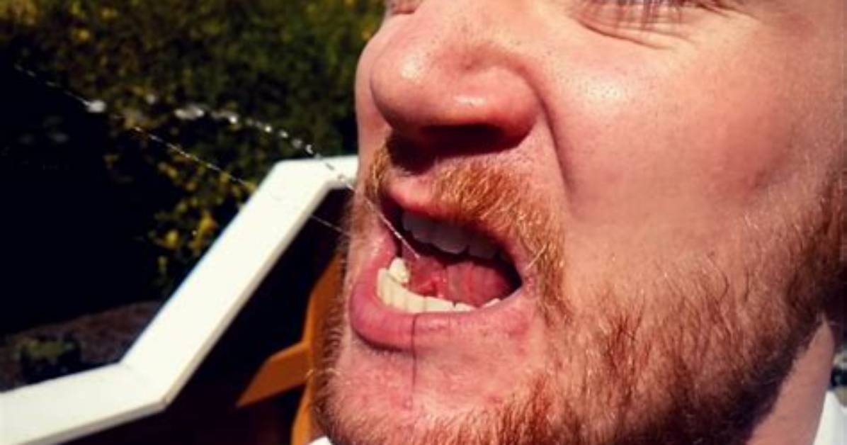 What Is Gleeking the Bizarre Saliva Spray Taking Over