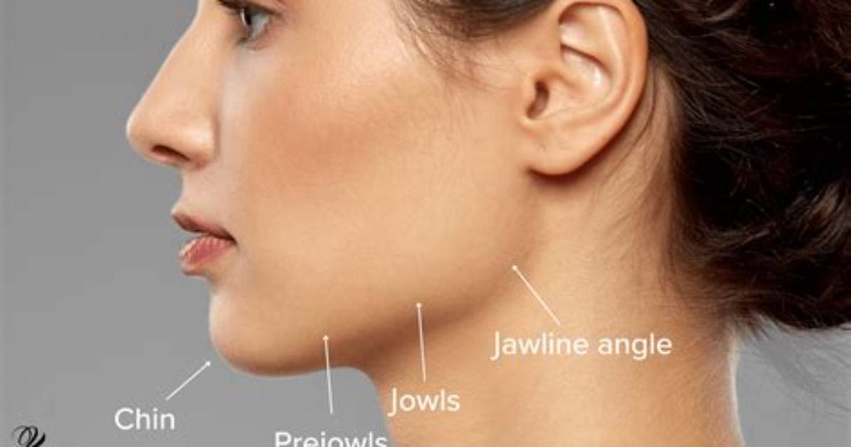 When a Bump on the Jaw Means Danger from Aflw Collision Trauma to Hidden