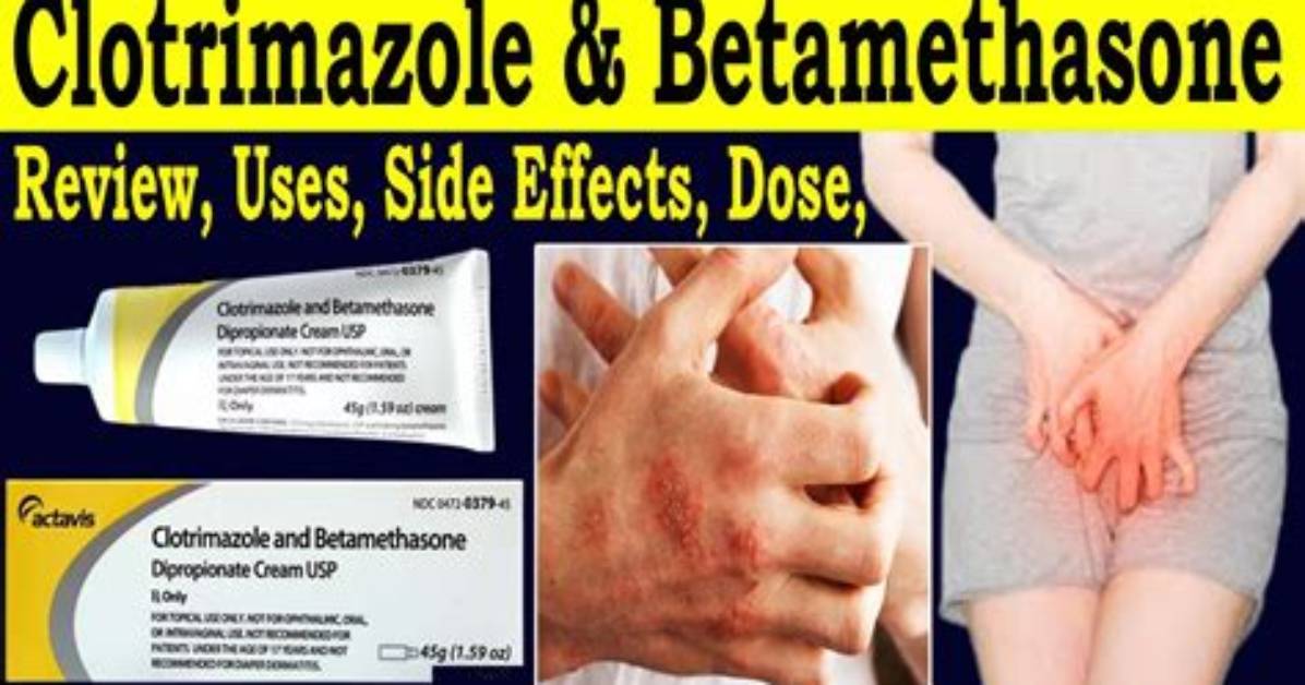 Why Putting Clotrimazole and Betamethasone On