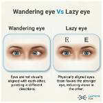 Why the 'Wandering Eye' Discourse Is Exploding Across Social Media Right Now