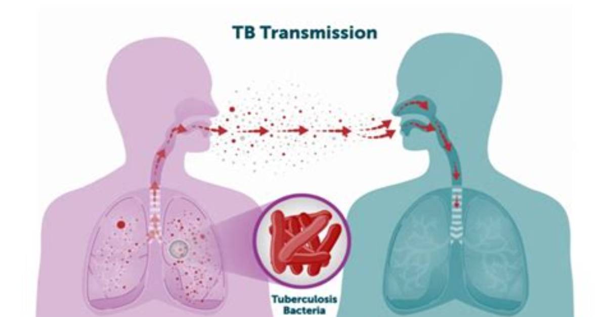 Why You Might Be Misinterpreting Tb in Texts and What the Sender