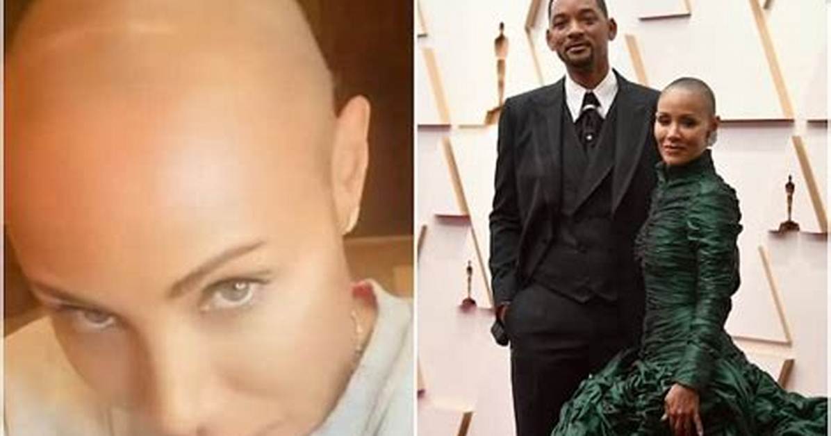 Will Smith S Wife and Alopecia Common Questions Cancer Rumors and What To